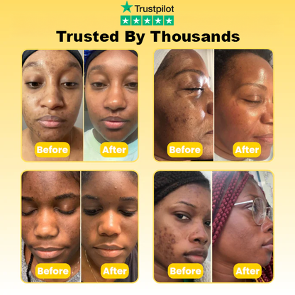 Lorrier Micro Infusion System™